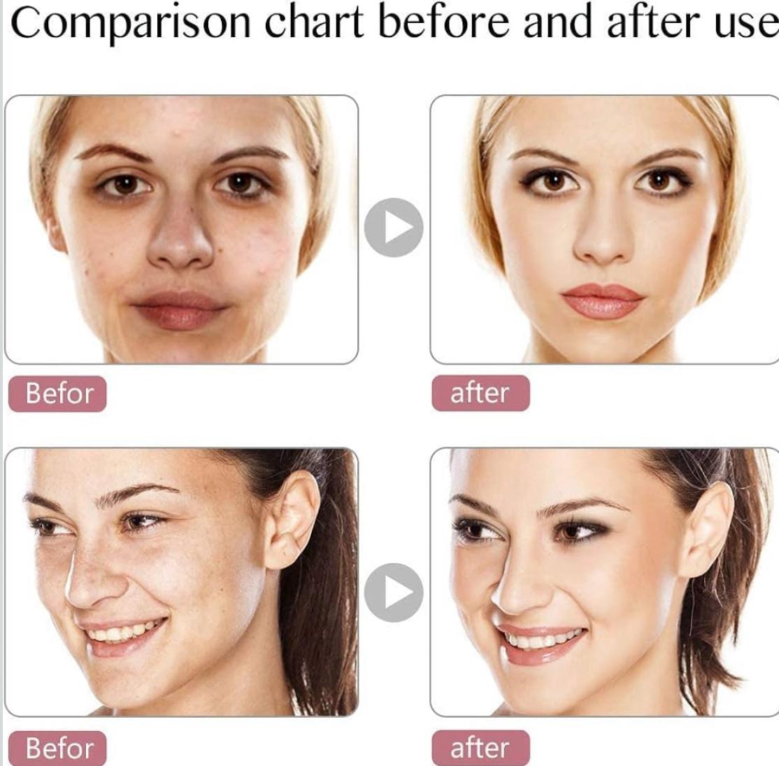 Device Led Face Mask Light Therapy, 7 Led Light Therapy Facial Skin Care Mask, Blue & Red Light for Acne Photon Mask, Korea PDT Technology for Acne Reduction.